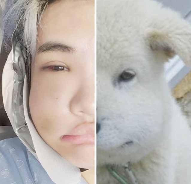 韩国男星晒整容前后对比，差距太大很惊人，被指最新照鼻尖像有坑