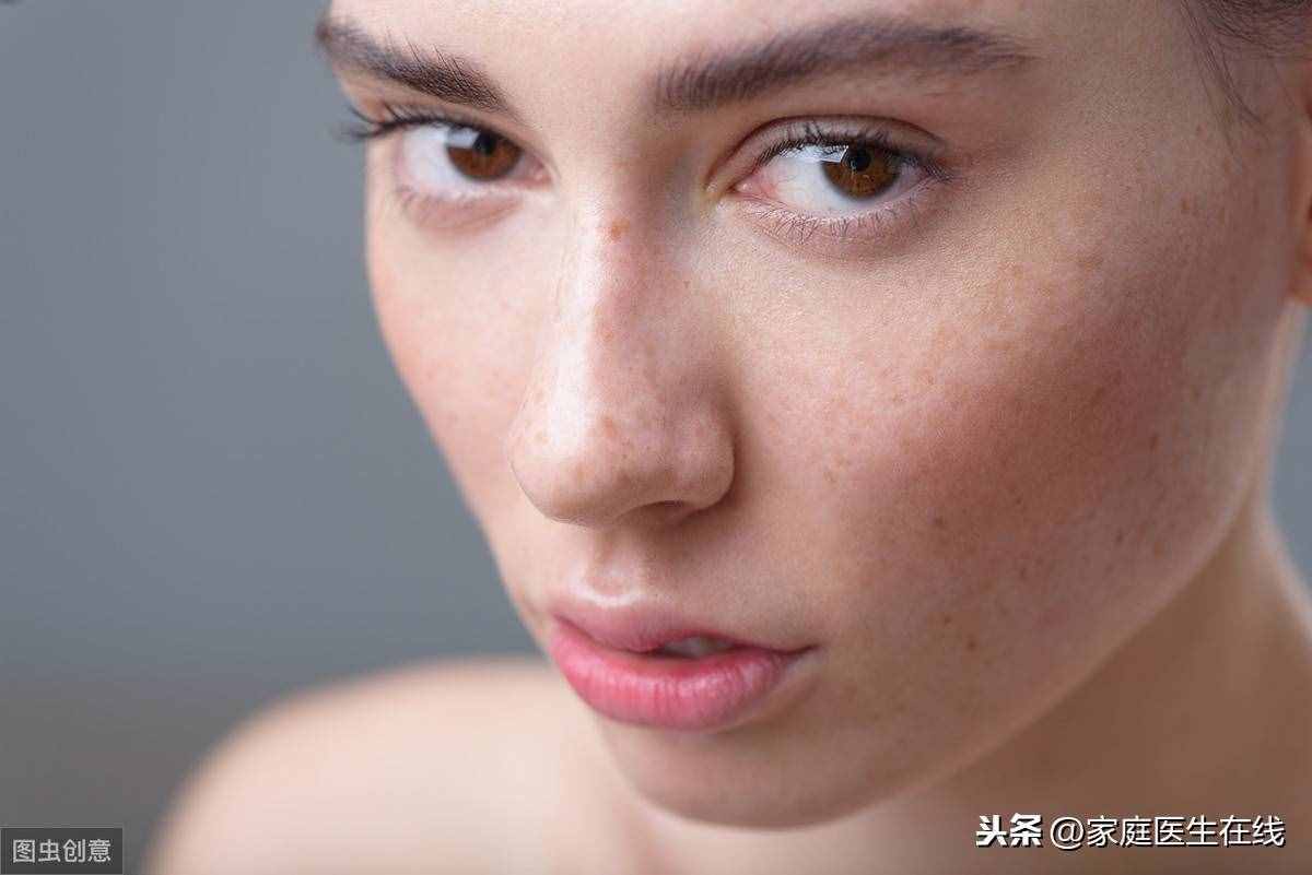 有红血丝如何护理？4个“工作”做好了，皮肤自然好转