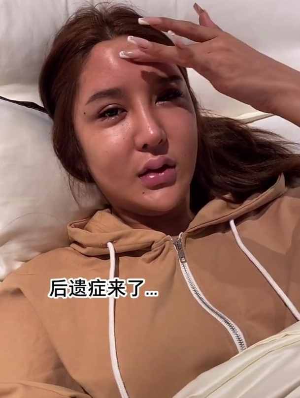 23岁网红整容出现后遗症，脸部浮肿额头凹陷，曾在6年内花费百万