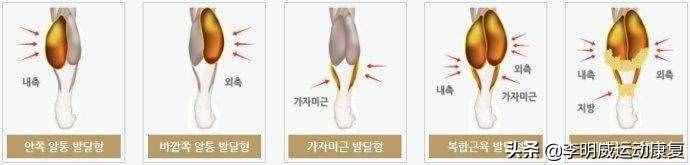 如何瘦小腿？原因和练习方案