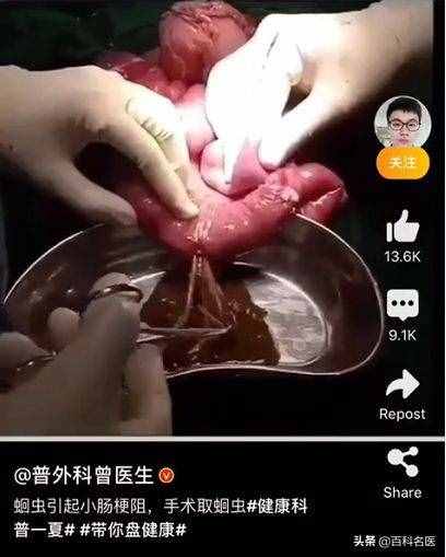 不用愁，肚子里有蛔虫，从两个方面就能驱逐它