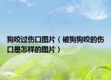 狗咬过伤口图片（被狗狗咬的伤口是怎样的图片）