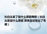 长白头发了是什么原因导致（长白头发是什么原因 原来是这里出了毛病）