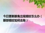今日更新眼角出现细纹怎么办（眼部细纹如何去除）