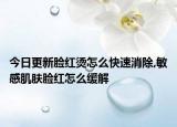 今日更新脸红烫怎么快速消除,敏感肌肤脸红怎么缓解