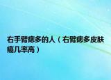 右手臂痣多的人（右臂痣多皮肤癌几率高）