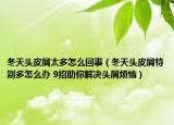 冬天头皮屑太多怎么回事（冬天头皮屑特别多怎么办 9招助你解决头屑烦恼）