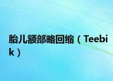 胎儿额部略回缩（Teebik）