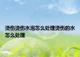 烫伤烫伤水泡怎么处理烫伤的水怎么处理