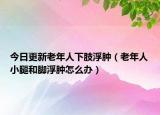 今日更新老年人下肢浮肿（老年人小腿和脚浮肿怎么办）