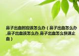 鼻子出血时应该怎么办（鼻子出血怎么办,鼻子出血该怎么办,鼻子出血怎么快速止血）