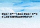 眼睛有红血丝什么情况（眼睛有红血丝是怎么回事 眼睛有红血丝有什么对策）