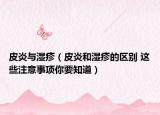皮炎与湿疹（皮炎和湿疹的区别 这些注意事项你要知道）