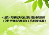 x线胶片经曝光洗片处理形成影像后简称（负片 经曝光和显影加工后得到的影像）