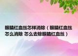 眼睛红血丝怎样消除（眼睛红血丝怎么消除 怎么去除眼睛红血丝）