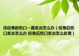洗纹身的伤口一直发炎怎么办（纹身后伤口发炎怎么办 纹身后伤口发炎怎么处理）