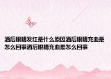 酒后眼睛发红是什么原因酒后眼睛充血是怎么回事酒后眼睛充血是怎么回事