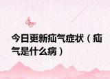 今日更新疝气症状（疝气是什么病）