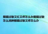 眼睛过敏又红又痒怎么办眼睛过敏怎么消肿眼睛过敏又痒怎么办