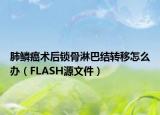 肺鳞癌术后锁骨淋巴结转移怎么办（FLASH源文件）