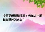 今日更新腿脚浮肿（老年人小腿和脚浮肿怎么办）