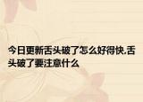 今日更新舌头破了怎么好得快,舌头破了要注意什么