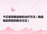 今日更新脑血栓的治疗方法（脑血栓的原因和解决方法）