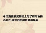 今日更新油溅到脸上好了有黑色的怎么办,被油溅的黑斑会消掉吗