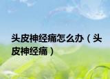 头皮神经痛怎么办（头皮神经痛）