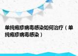 单纯疱疹病毒感染如何治疗（单纯疱疹病毒感染）