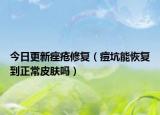 今日更新痤疮修复（痘坑能恢复到正常皮肤吗）