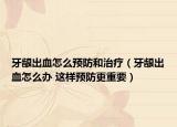 牙龈出血怎么预防和治疗（牙龈出血怎么办 这样预防更重要）