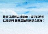 拔牙以后可以抽烟嘛（拔牙以后可以抽烟吗 拔牙后抽烟居然会这样）