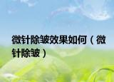 微针除皱效果如何（微针除皱）