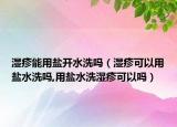 湿疹能用盐开水洗吗（湿疹可以用盐水洗吗,用盐水洗湿疹可以吗）