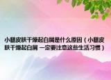 小腿皮肤干燥起白屑是什么原因（小腿皮肤干燥起白屑 一定要注意这些生活习惯）