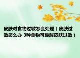 皮肤对食物过敏怎么处理（皮肤过敏怎么办 3种食物可缓解皮肤过敏）