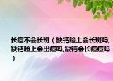 长痘不会长斑（缺钙脸上会长斑吗,缺钙脸上会出痘吗,缺钙会长痘痘吗）