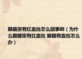 眼睛里有红血丝怎么回事啊（为什么眼睛里有红血丝 眼睛有血丝怎么办）