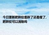 今日更新肥胖纹是胖了还是瘦了,肥胖纹可以消除吗