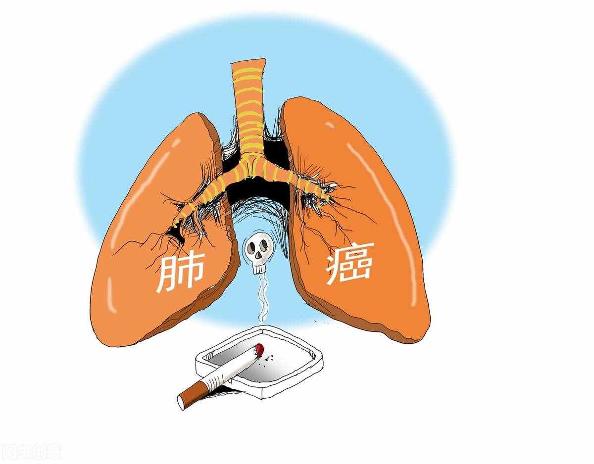 肺癌患者饮食怎么吃，这几样食物，帮助抵抗肺癌