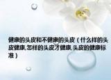 健康的头皮和不健康的头皮（什么样的头皮健康,怎样的头皮才健康,头皮的健康标准）