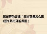 氟斑牙的表现（氟斑牙是怎么形成的,氟斑牙的原因）