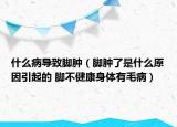 什么病导致脚肿（脚肿了是什么原因引起的 脚不健康身体有毛病）