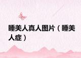 睡美人真人图片（睡美人症）