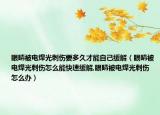 眼睛被电焊光刺伤要多久才能自己缓解（眼睛被电焊光刺伤怎么能快速缓解,眼睛被电焊光刺伤怎么办）