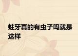 蛀牙真的有虫子吗就是这样