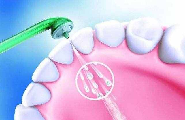 什么是洗牙？洗牙有没有必要？