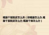嘴唇干裂脱皮怎么弄（舔嘴唇怎么办,嘴唇干裂脱皮怎么办,嘴唇干燥怎么办）