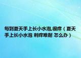 每到夏天手上长小水泡,很痒（夏天手上长小水泡 刺痒难耐 怎么办）